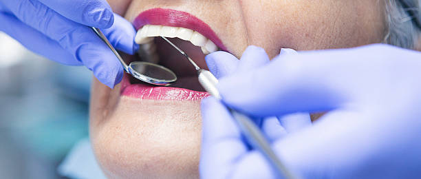 Best Emergency Gum Treatment in Francisville, KY